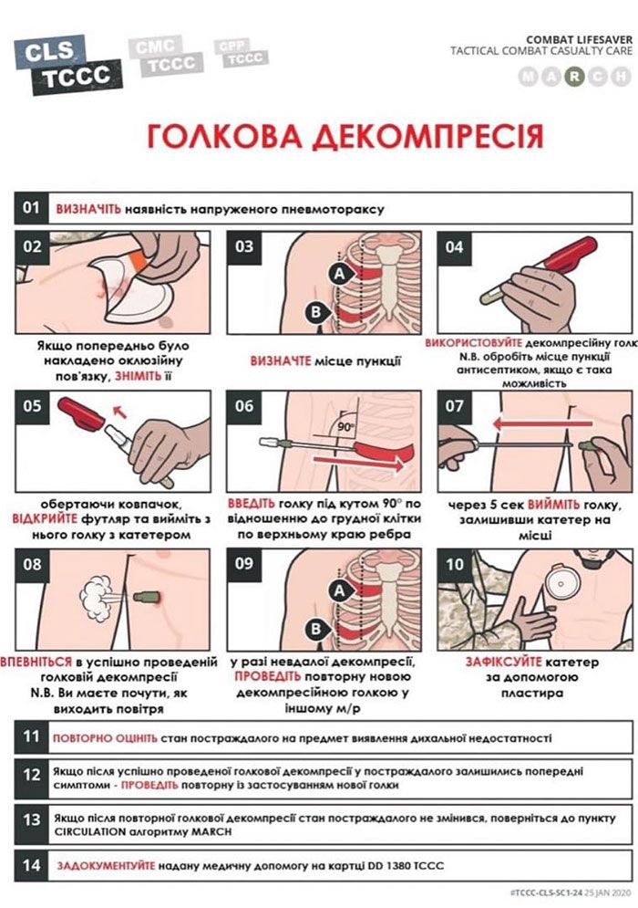 Использование противопролежневого матраса алгоритм кратко